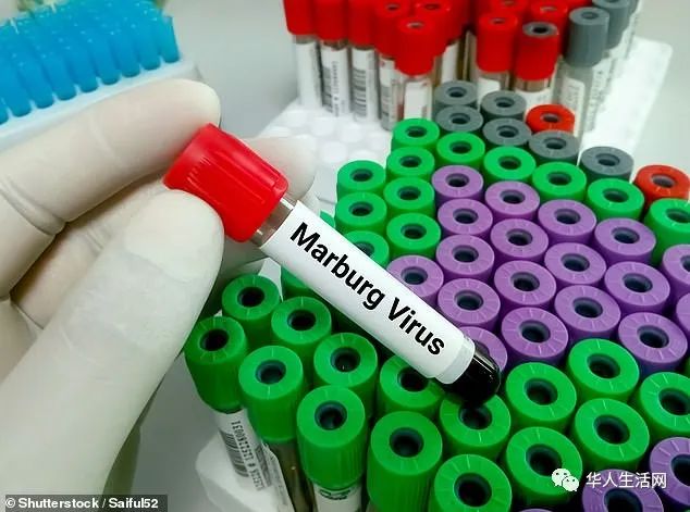 埃博拉病毒的一个致命表亲 最致命马尔堡病毒来袭 第二次在西非被发现