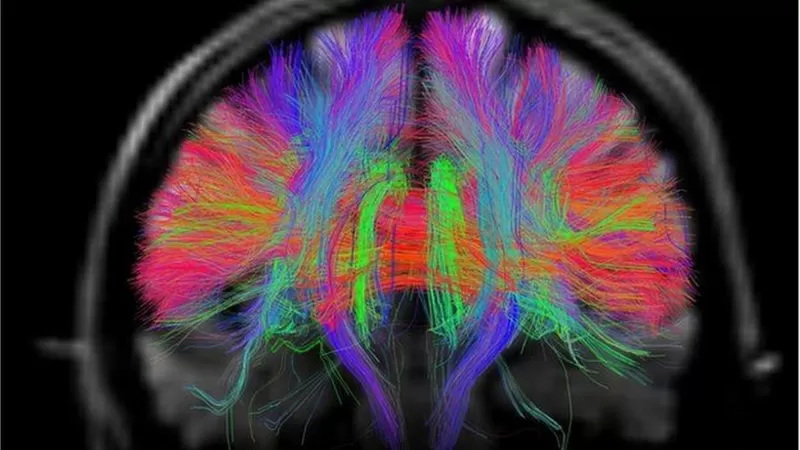人类的大脑