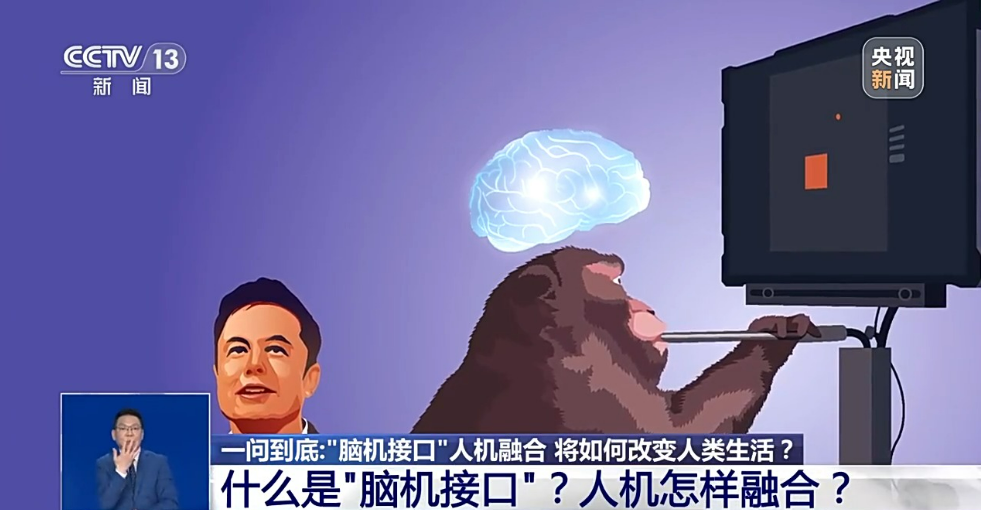 脑机接口