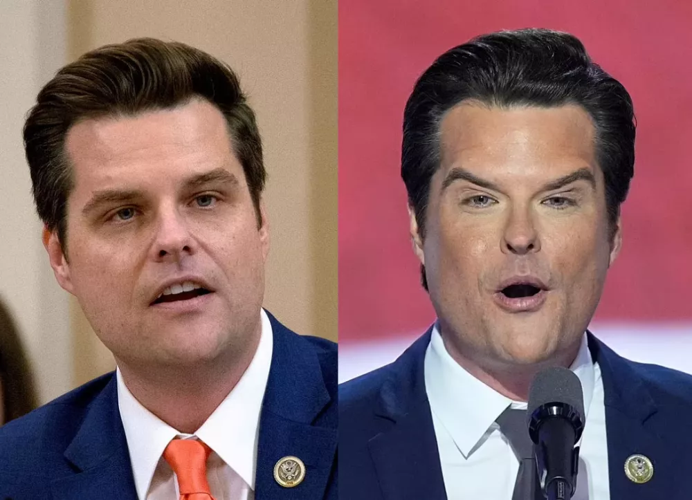 前美国众议员马特·盖茨 (Matt Gaetz)就曾在去年因明显的容貌改变而引发过争议 ...